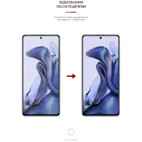 Купити Гідрогелева плівка ArmorStandart Anti-Blue для Xiaomi 11T (ARM61222) - фото 3