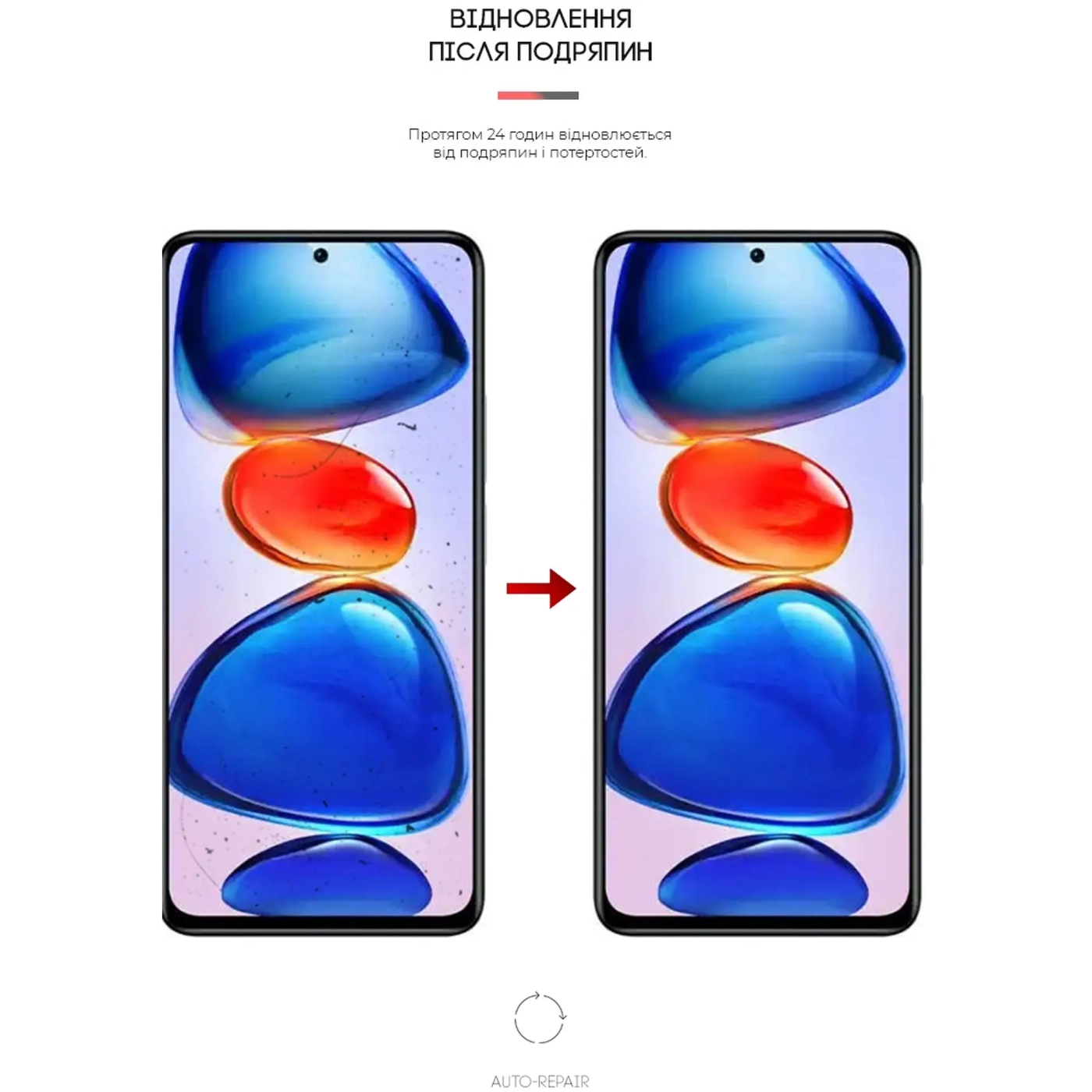 Купить Гидрогелевая пленка ArmorStandart Anti-Blue для Xiaomi Redmi Note 11E Pro/Note 11 Pro 5G (ARM63334) - фото 3