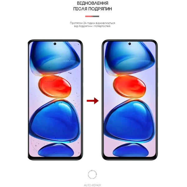 Купить Гидрогелевая пленка ArmorStandart Anti-Blue для Xiaomi Redmi Note 11E Pro/Note 11 Pro 5G (ARM63334) - фото 3
